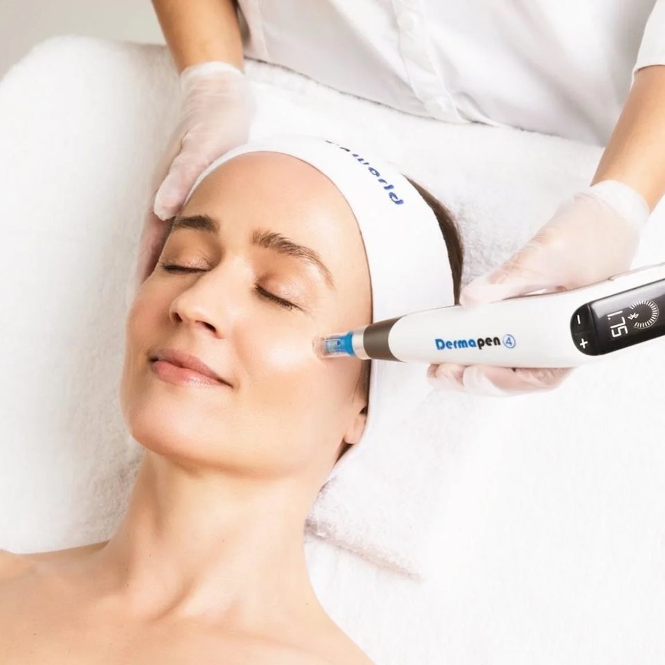 Microneedling